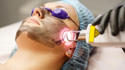 Dubai Laser Scar Removal: Boost Confidence with Smooth Skin