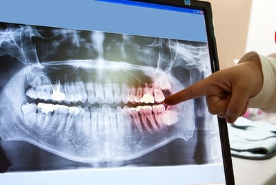 Panoramic Dental Clinic Dubai Appointment