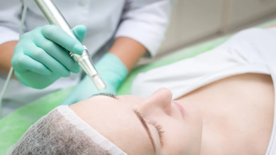 How Many Sessions Are Required for Microneedling?