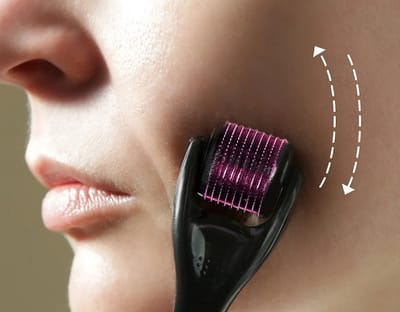 What Role Do Needles Play in Derma Rollers Treatment?