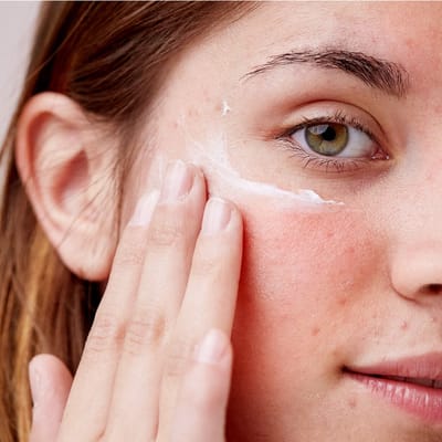 Which Skin Care Treatments Help Reduce Redness?