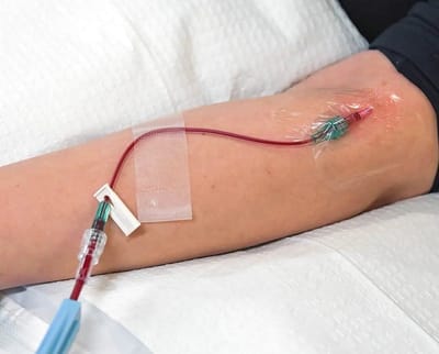 Can Ozone Therapy Be Done at Home?