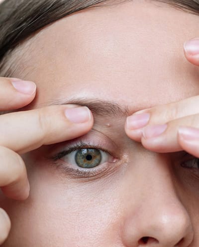What age is suitable for Milia Treatment?
