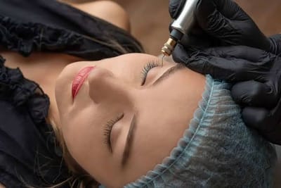 Is Plasma Pen Treatment better than surgery?