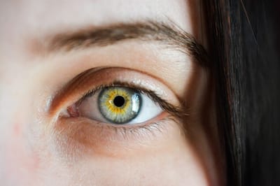 Is an Eyebrow Transplant a permanent solution?