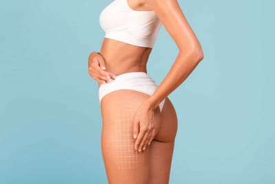 How does a specialist decide which dimples to treat?