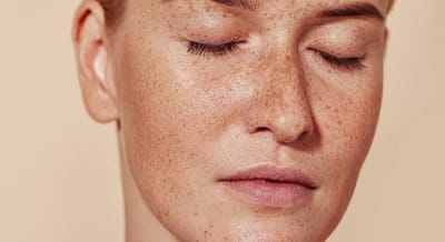 How many treatments are needed for Dermal Pigmentation?