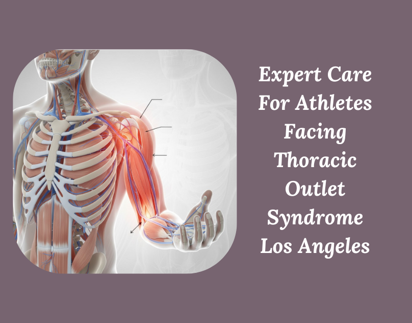 Thoracic Outlet Syndrome Specialist in Los Angeles