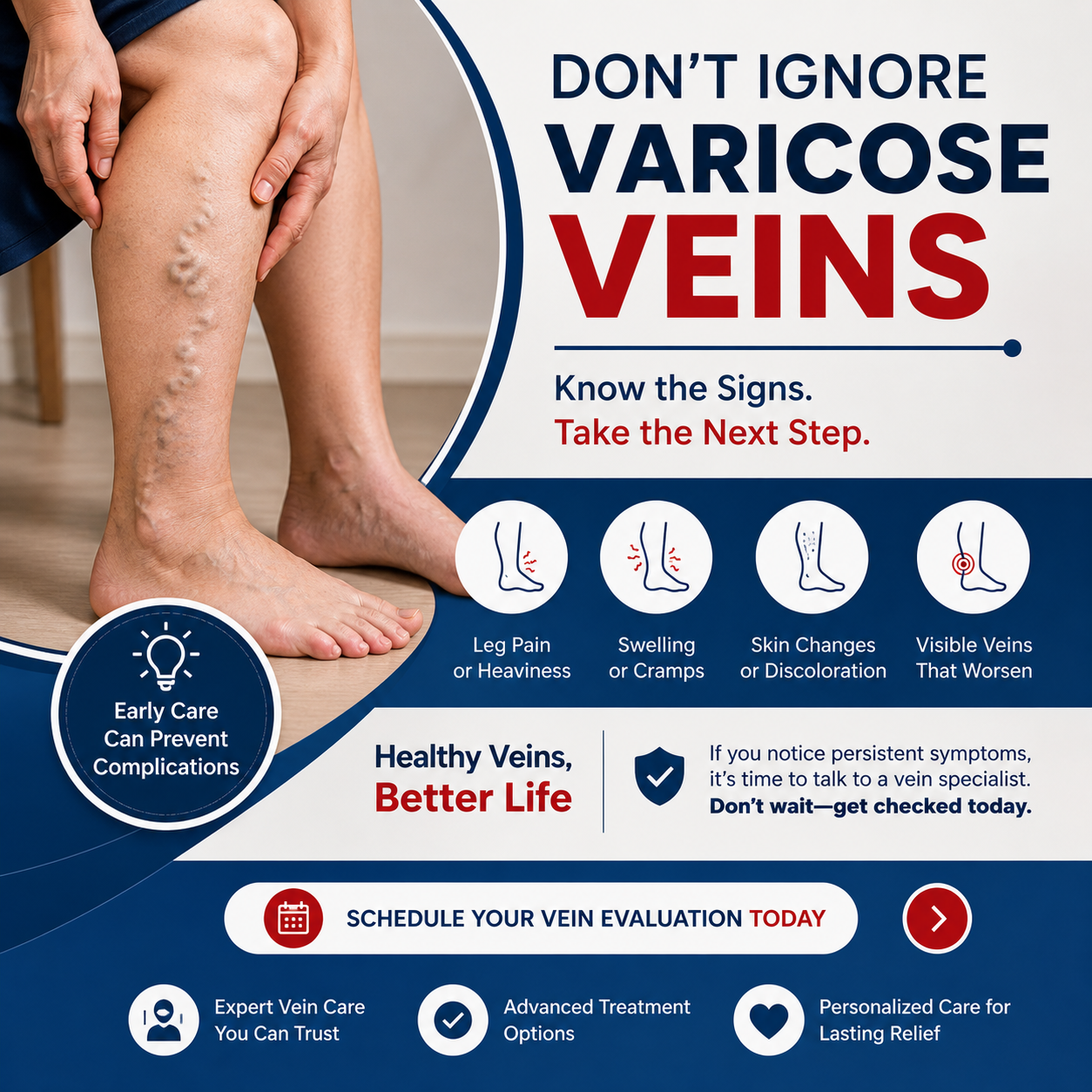 Varicose Veins