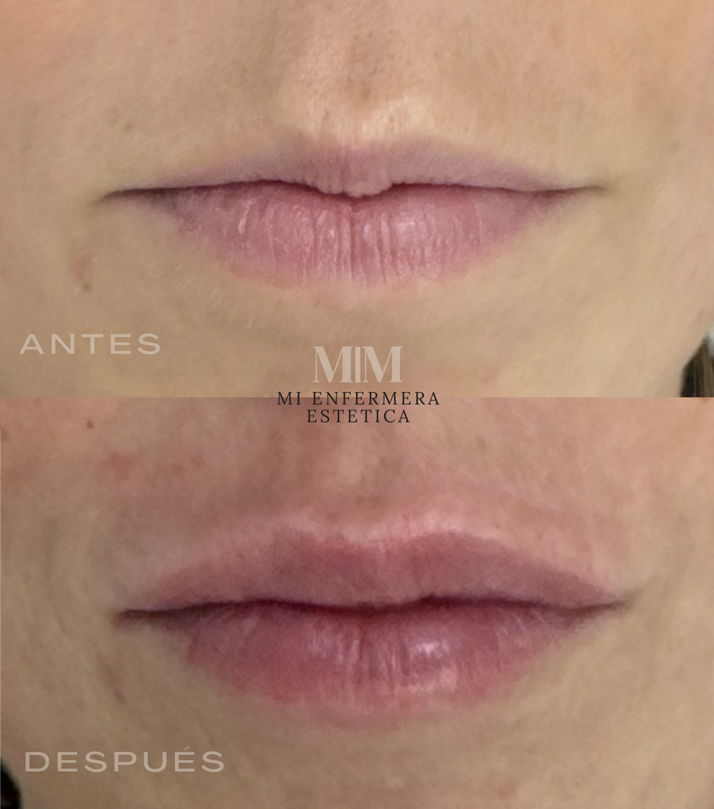 LABIOS