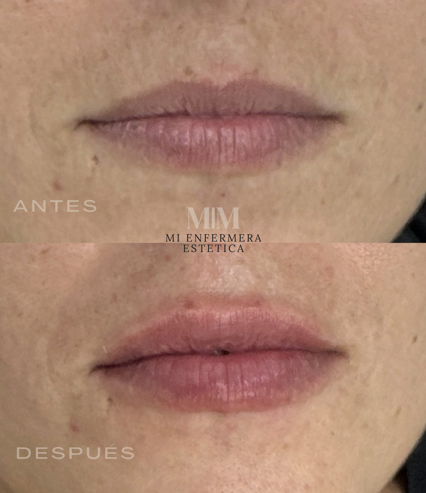 LABIOS