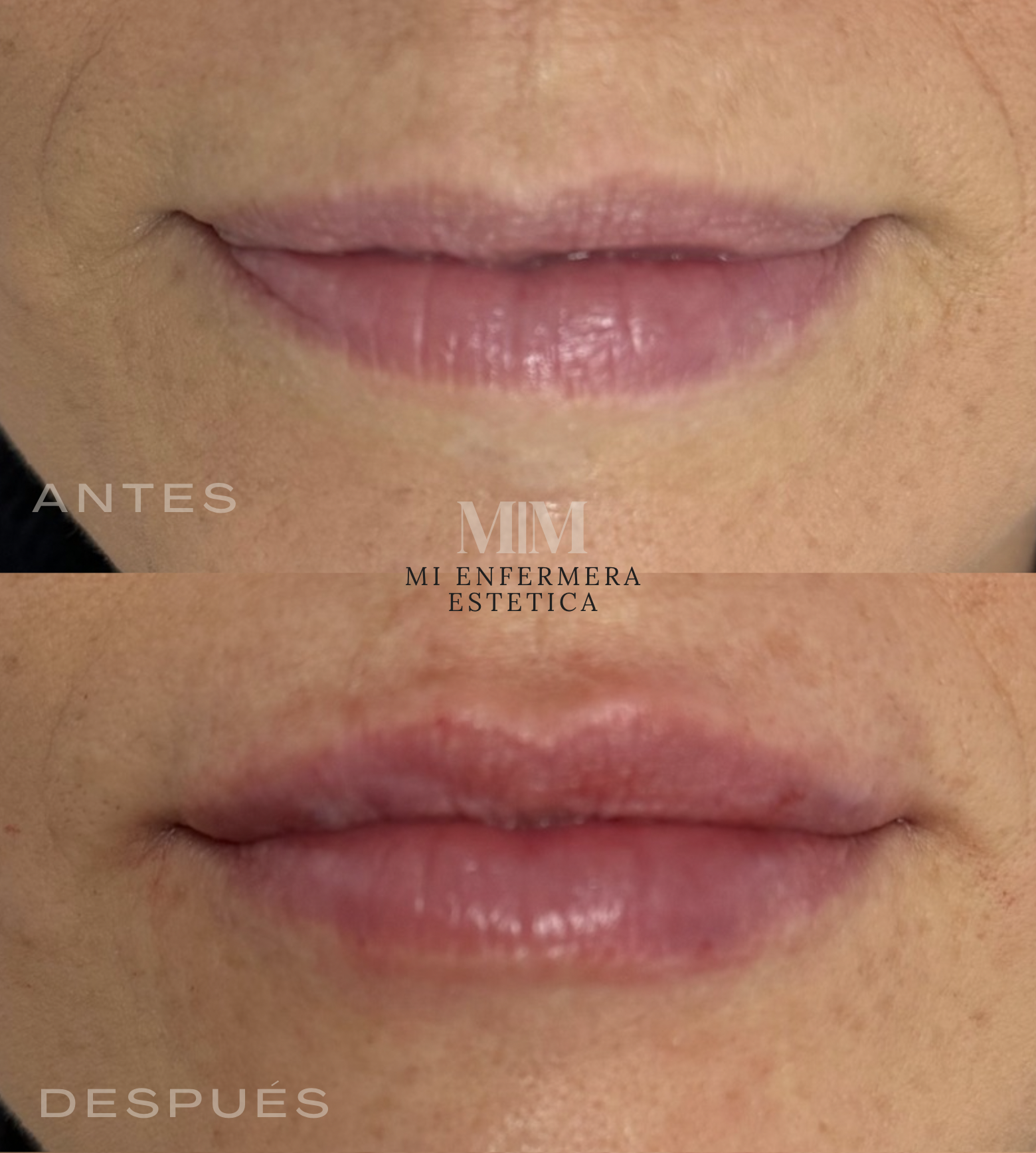 LABIOS