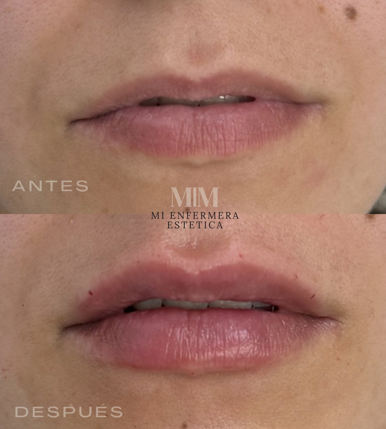LABIOS