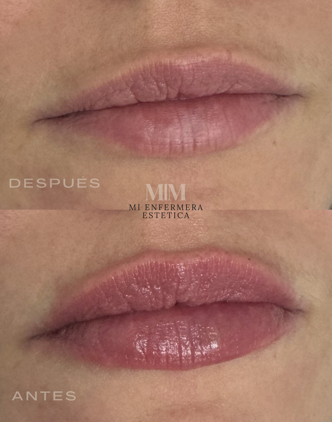 LABIOS