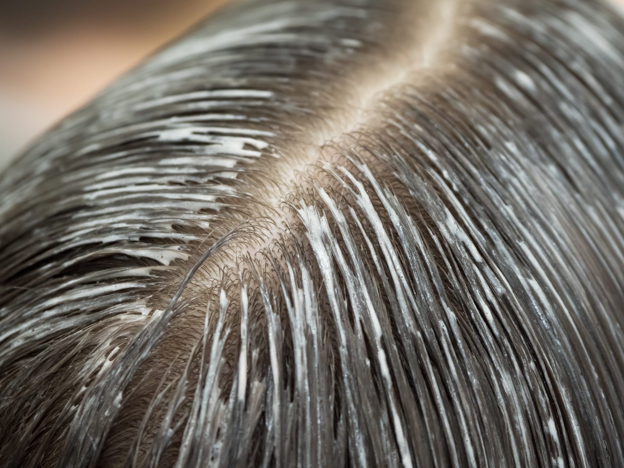 Peeling enzymatyczny skóry głowy z terapią infuzyjną peptydowo-nawilżającą