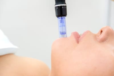 Mezoterapia mikroigłowa