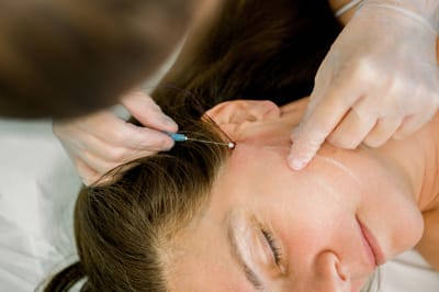 Nici rewitalizujące PDO i PLLA