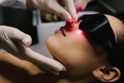 Usuwanie włókniaków - precyzyjna, bezpieczna i skuteczna eliminacja zmian skórnych