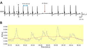 Reiki a distance et frequences
