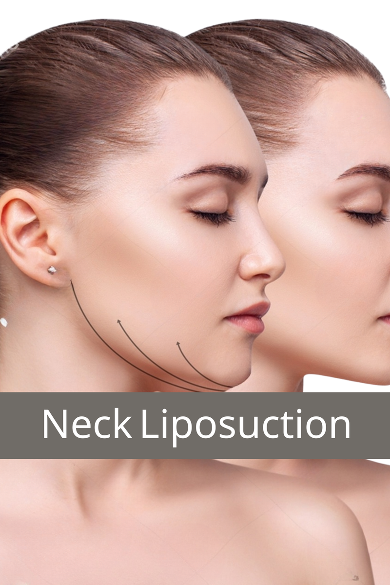 Neck Procedure by Dr. Tawalbeh