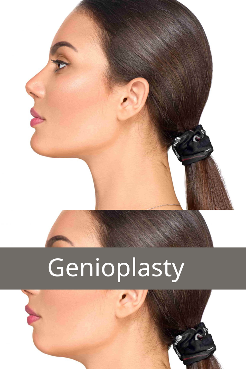 Face and Jaw surgery