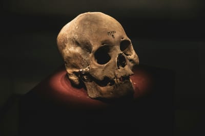 MGANGA WA KIENYEJI NAROK TOWN