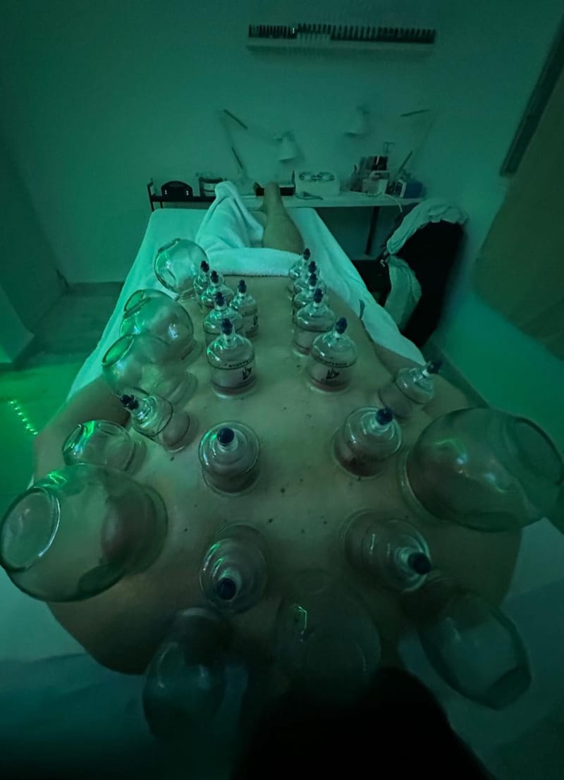 טיפול בכוסות רוח