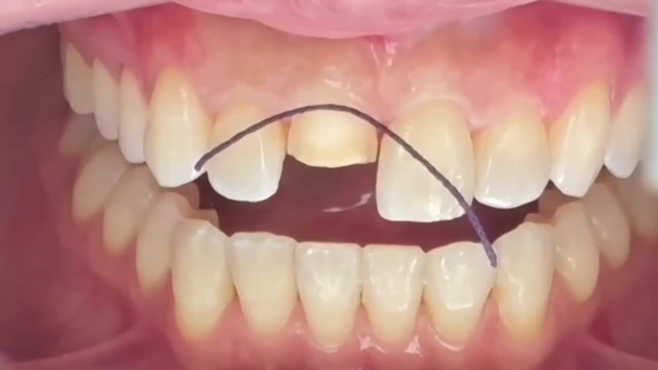 How to Use Retraction Clean Cord: