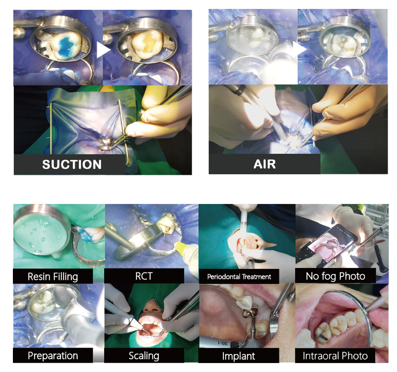 CyClean Mirror Plus — Dental Mirror with Integrated Air and Suction