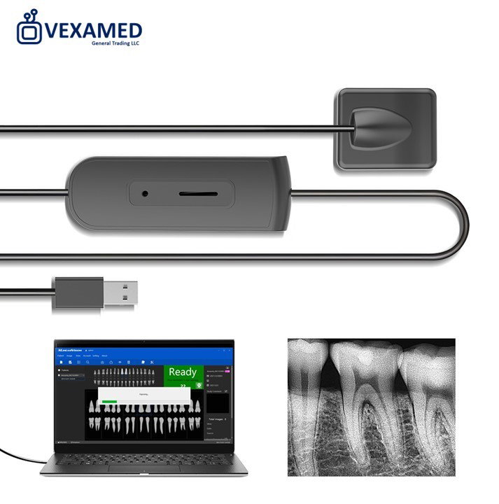Digital Dental Intraoral X-Ray Sensor