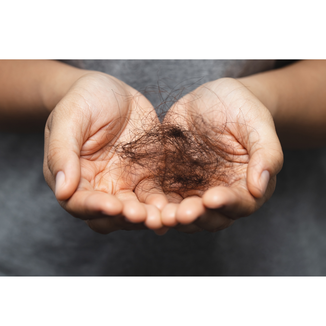 Why Your Hair Is Falling — A Physician Explains Hair Loss