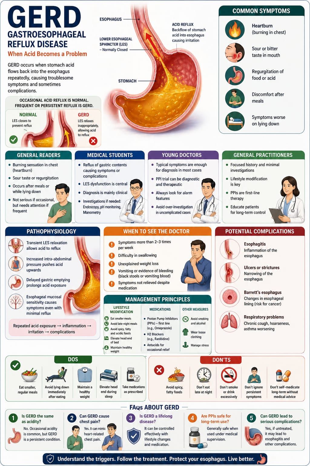 Gastroesophageal Reflux Disease (GERD): When Acid Becomes a Problem