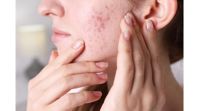 What Your Skin Can Reveal About Your Health