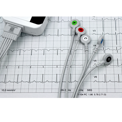 Why Your Heart Races Without Exercise — A Physician Explains