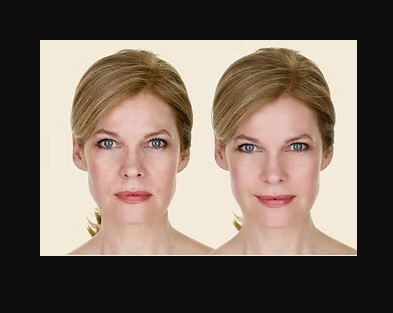 Best Medical Spa Brandon Services for Smoother, Healthier Skin