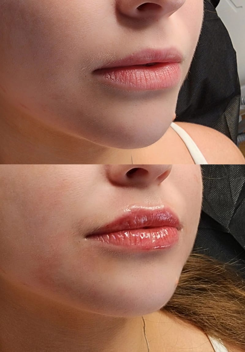 עיצוב שפתיים