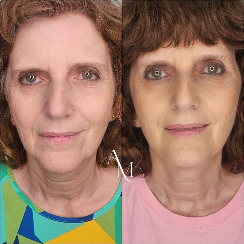 ביוסטימולטורים