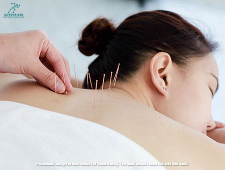 Dry Needling