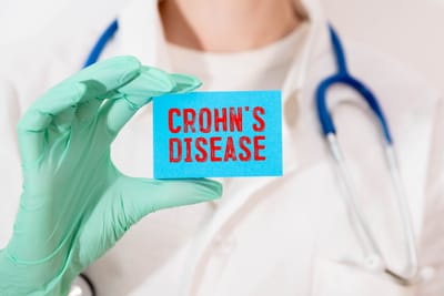 ΝΟΣΟΣ CROHN ΚΑΙ ΕΛΚΩΔΗΣ ΚΟΛΙΤΙΔΑ