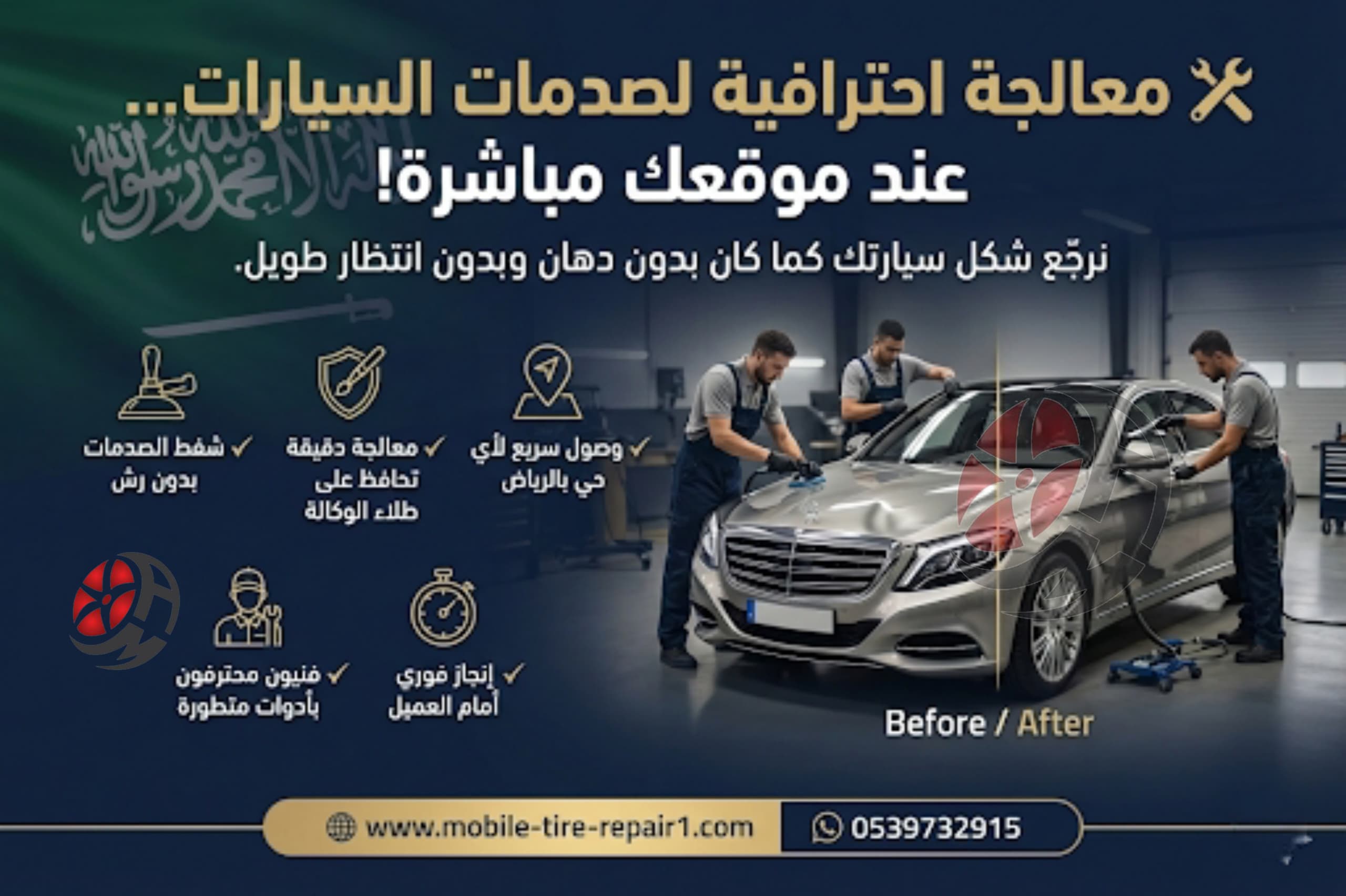 خدمة شفط الصدمات