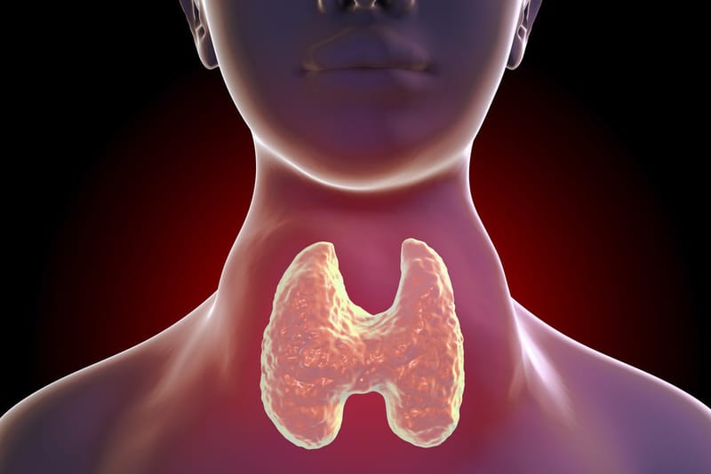 Hypothyroidism