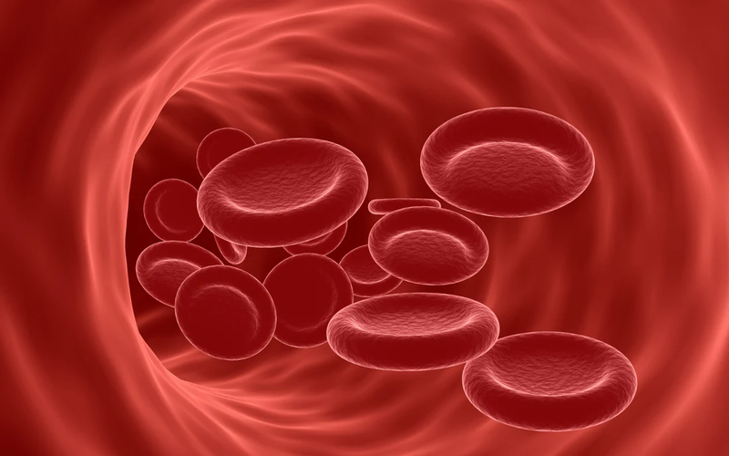 Iron Deficiency Anemia