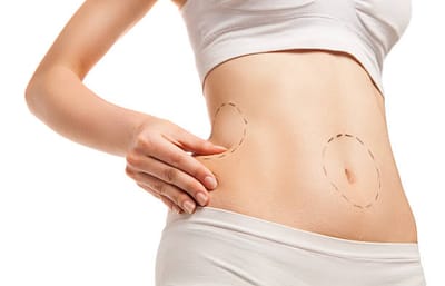 Liposuction in Riyadh: Best Age to Undergo the Procedure