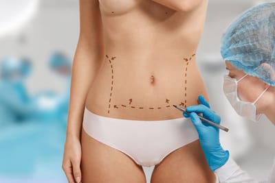 How to Finance Your Tummy Tuck Surgery in Riyadh: Tips and Options