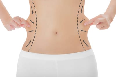 Lipo Abdominoplasty in Riyadh: What Makes It Different?