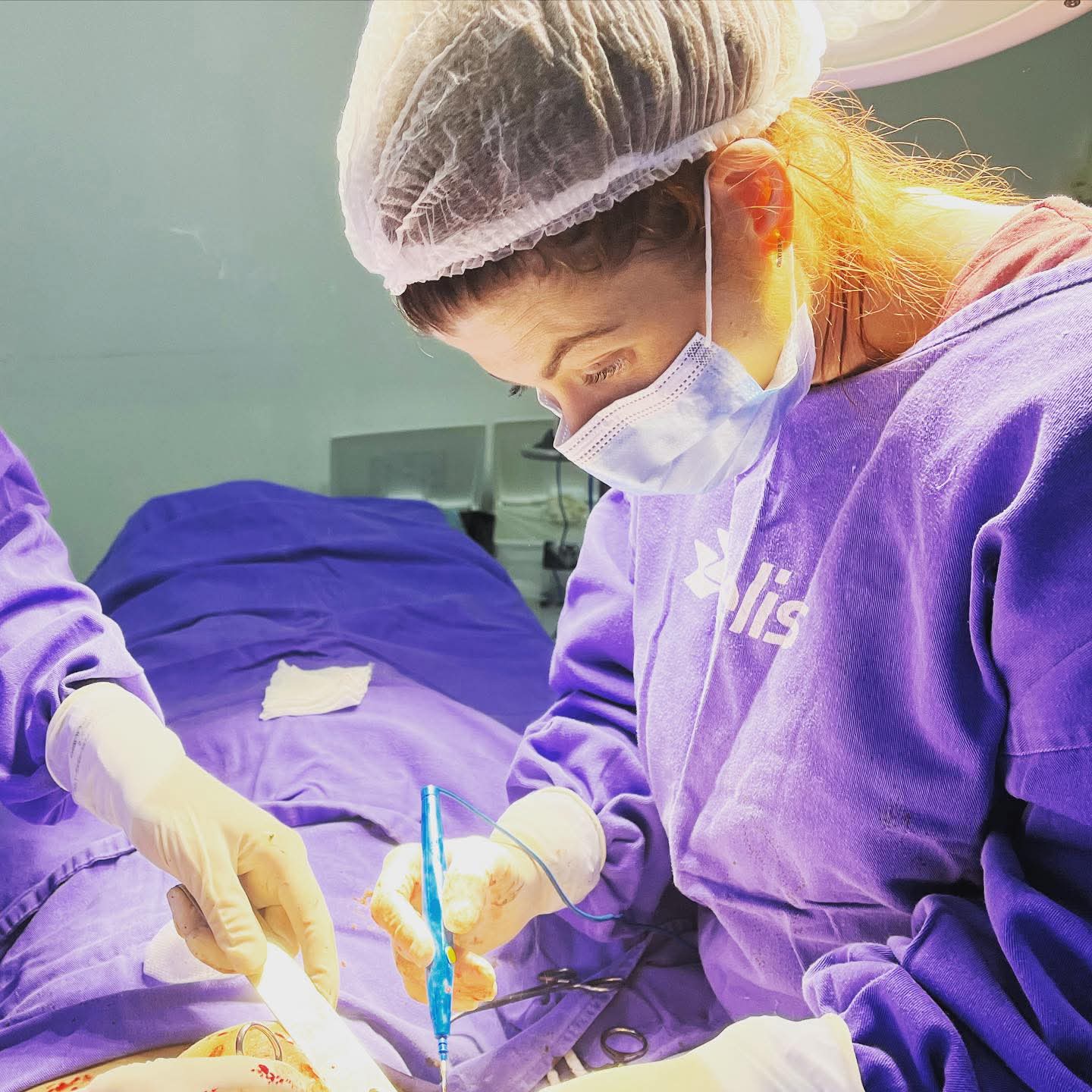 Reconstrução com Prótese Mamária em Pacientes Câncer de Mama com ou Sem Explante de Prótese prévia Unilaterais ou Bilaterais. Tratamento Inicial com Exérese do Tumor e Biópsia de Linfonodo Sentinela.