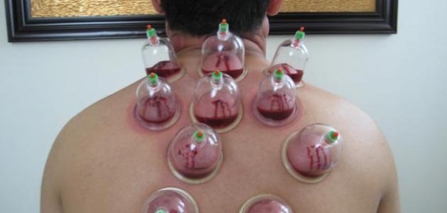 تنظيف السموم من الجسم