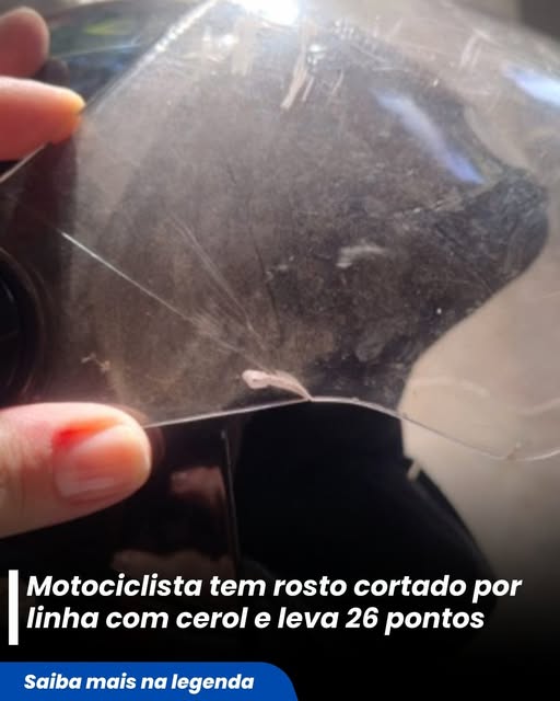 MOTOCICLISTA LEVA 26 PONTOS NO ROSTO POR CAUSA DE LINHA DE CEROL