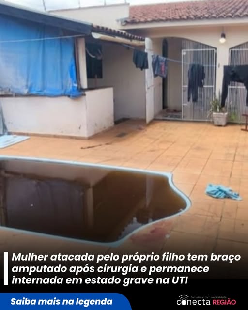 FILHO É PRESO AO TENTAR MATAR A MÃE QUE TEVE BRAÇO AMPUTADO