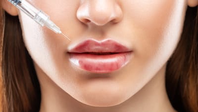 Add natural lip dimension with Dermal Fillers for perfect lips